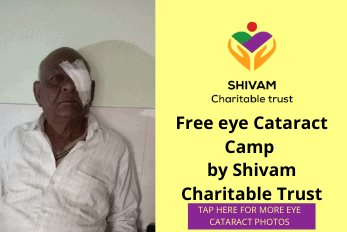 FREE EYE CATRACT CAMP